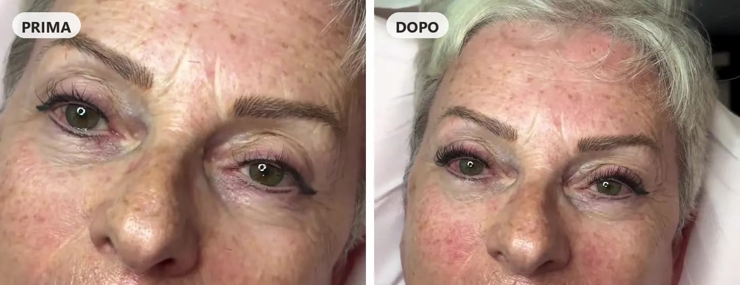 Prima e dopo: ciglia dopo sei settimane dall'ultimo set e subito dopo il refill di extension